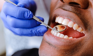 Patient receiving dental exam