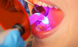 Patient receiving dental bonding