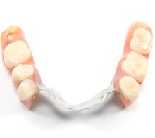 partial denture