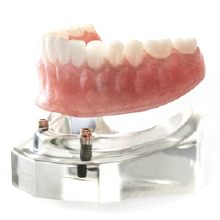 implant-supported denture