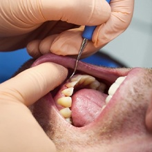 man open mouth dentist