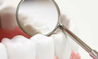 Closeup of teeth with dental sealants