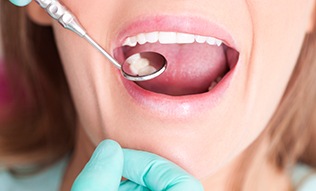 Patient receiving dental exam